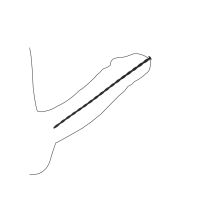 Ouch! Spiral dilatorsæt i silikone til begyndere, billede 5
